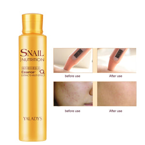 Whitening Skin Toner